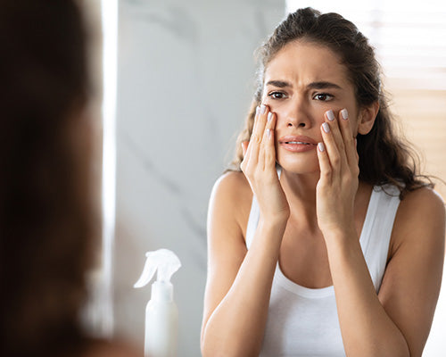 Is There an Anti-Acne Diet?