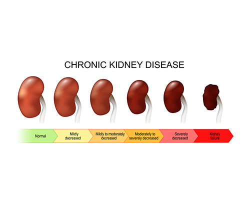 Good Nutrition and Kidney Disease – Healthy Options