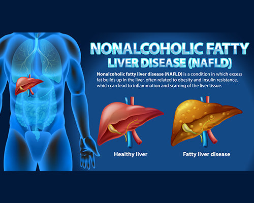 Non-alcoholic Fatty Liver Disease (NAFLD)